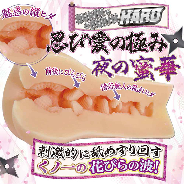 ���̂������r�e�[�V����